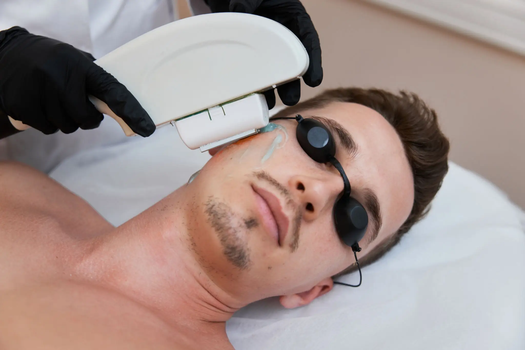 Laser skincare treatment on man's face